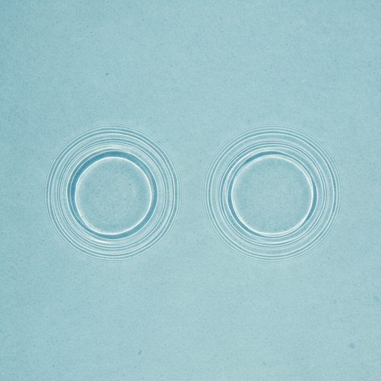 Bilateral Deafness: A Complete Guide to Causes, Diagnosis, and Management