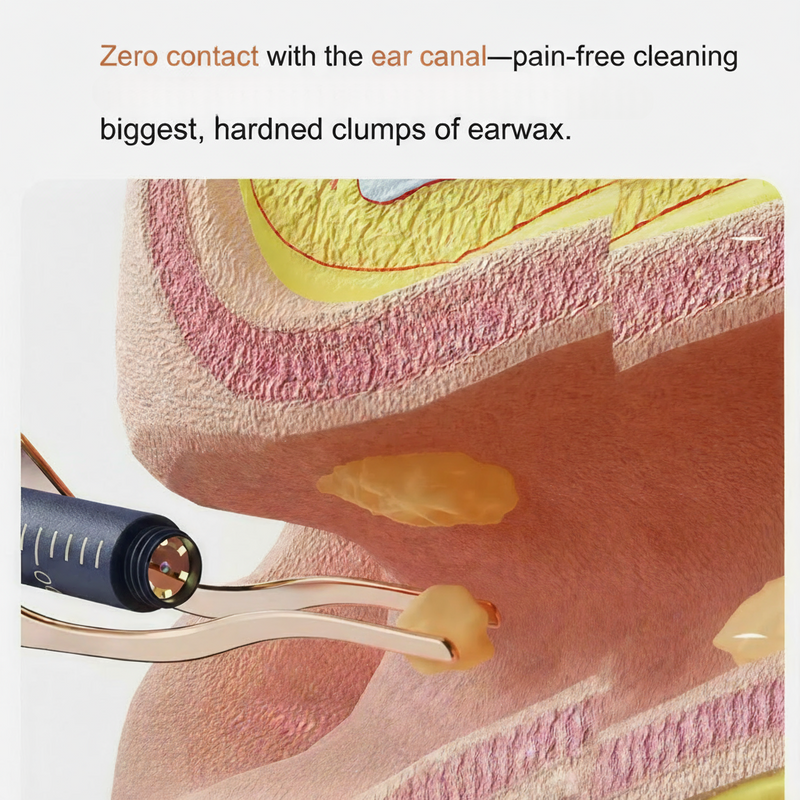 Bild in den Galerie-Viewer laden, Visueller Ohrreiniger | Entwickelt für gehörlose und schwerhörige Menschen | HD-Endoskop + WLAN-Verbindung | Intelligente Temperaturkontrolle | Schmerzfreie Reinigung | Kein blindes Kratzen mehr | Familienfreundlich
