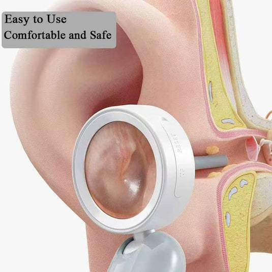 Smartes visuelles Ohrendoskop mit HD-Display | Klare Inspektionshilfe für die Ohrgesundheit für gehörlose und schwerhörige Menschen